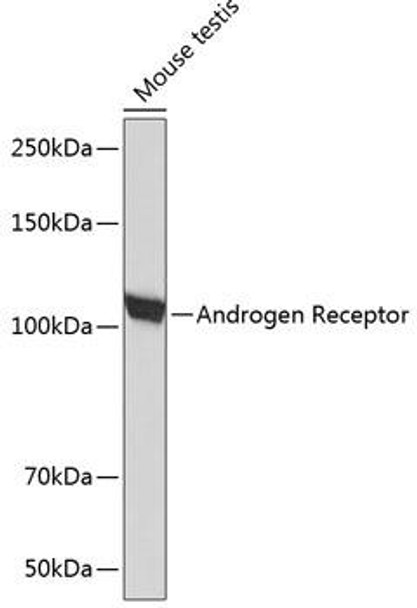 Anti-Androgen Receptor Antibody (CAB19611)