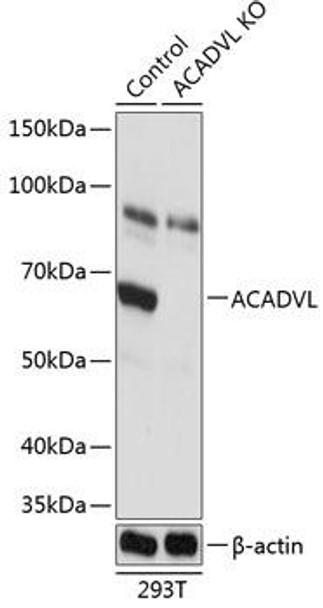 Anti-ACADVL Antibody (CAB19973)[KO Validated]