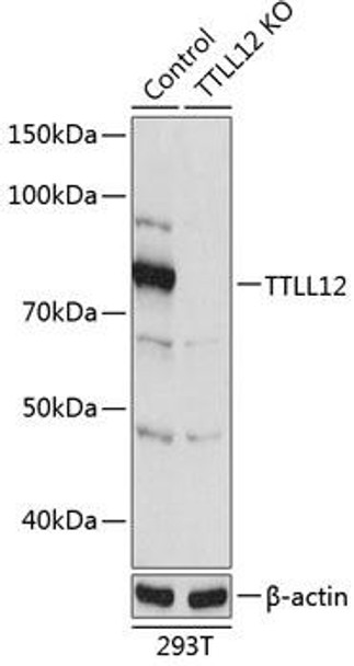 Anti-TTLL12 Antibody (CAB19994)[KO Validated]