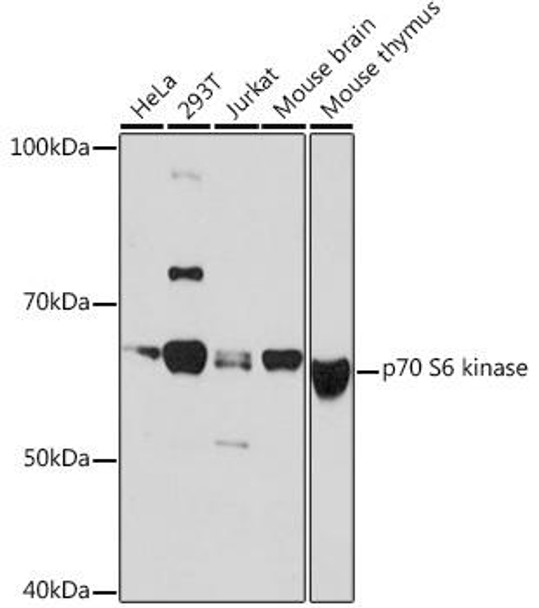 Anti-p70 S6 kinase Antibody (CAB4898)