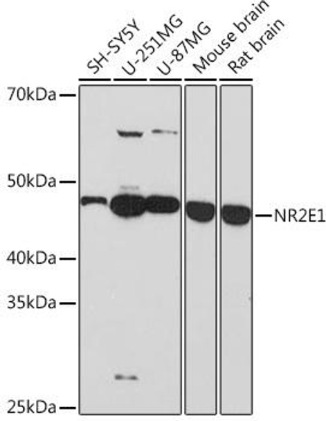 Anti-NR2E1 Antibody (CAB8768)
