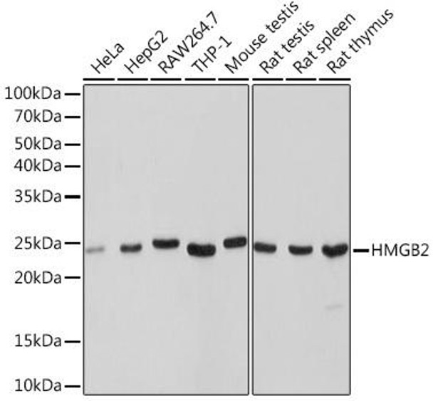 Anti-HMGB2 Antibody (CAB9168)