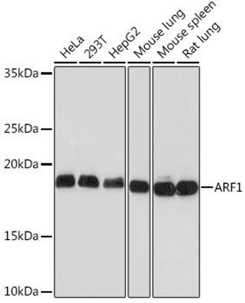 Anti-ARF1 Antibody (CAB9195)