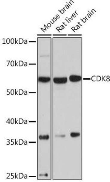 Anti-CDK8 Antibody (CAB9654)