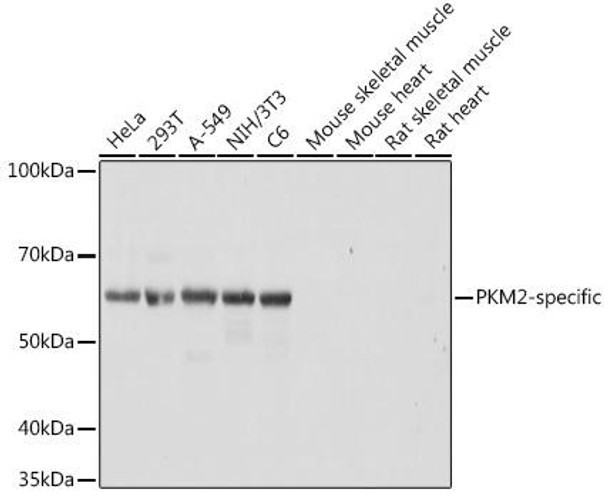 Anti-PKM2-specific Antibody (CAB18799)