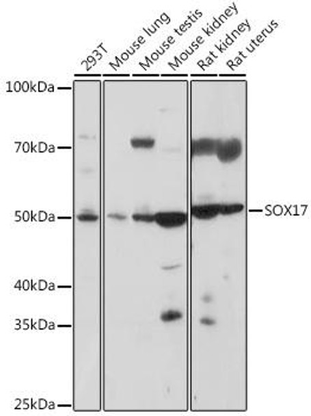Anti-SOX17 Antibody (CAB18858)