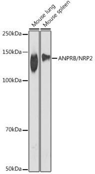 Anti-ANPRB/NRP2 Antibody (CAB19255)