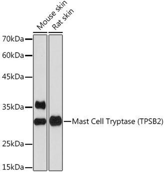 Anti-Mast Cell Tryptase (TPSB2) Antibody (CAB19801)
