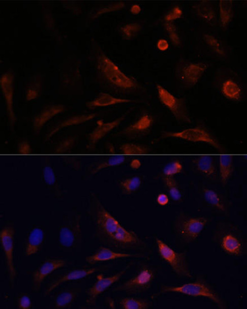 Anti-CLDN5 Antibody (CAB10207)