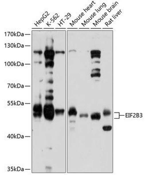 Anti-EIF2B3 Antibody (CAB10262)