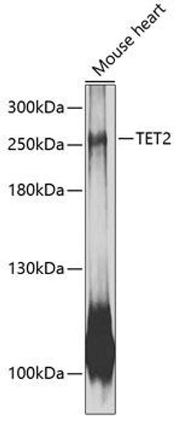 Anti-TET2 Antibody (CAB12779)