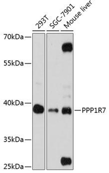 Anti-PPP1R7 Antibody (CAB13041)