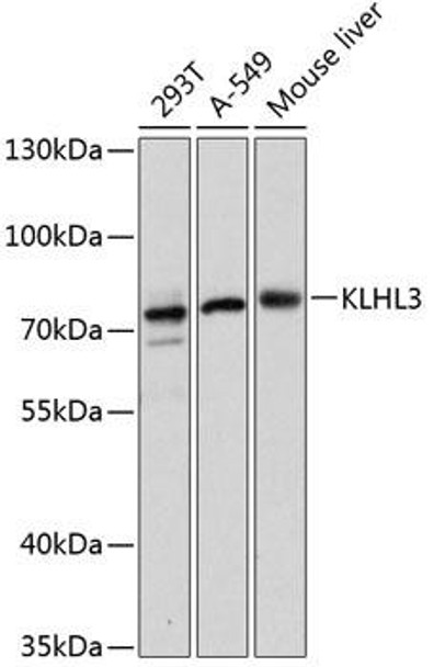 Anti-KLHL3 Antibody (CAB13771)