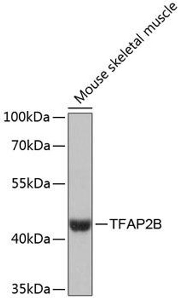 Anti-TFAP2B Antibody (CAB13885)
