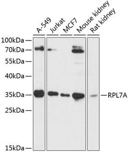 Anti-RPL7A Antibody (CAB14060)