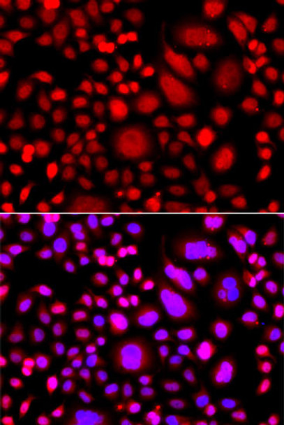 Anti-PRKAG3 Antibody (CAB14132)