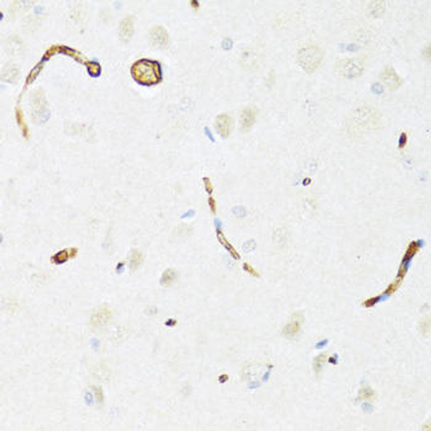 Anti-P Glycoprotein Antibody (CAB14765)