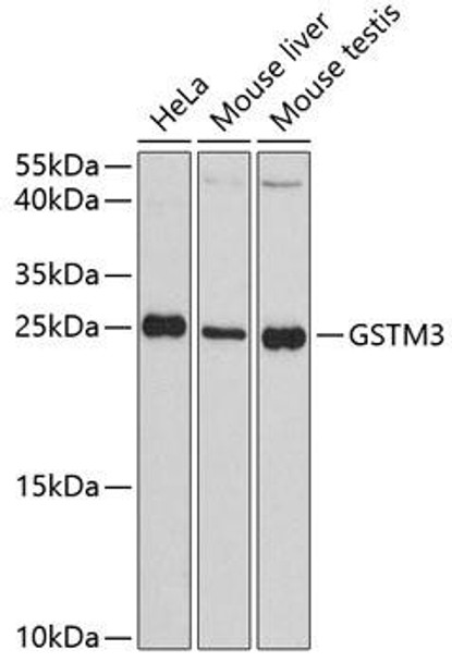 Anti-GSTM3 Antibody (CAB3905)