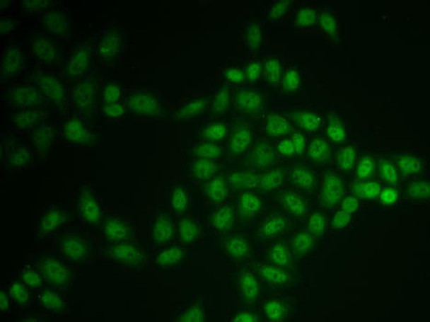 Anti-BTG1 Antibody (CAB6359)