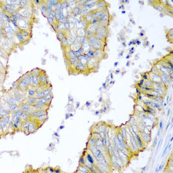 Anti-KRBOX4 Antibody (CAB6471)