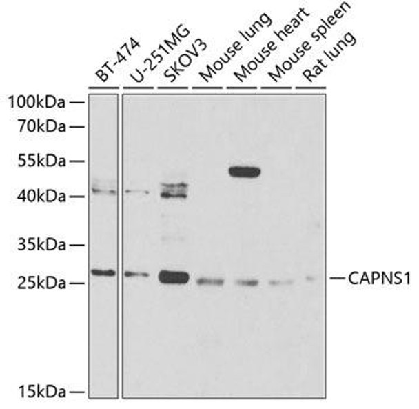 Anti-CAPNS1 Antibody (CAB6539)