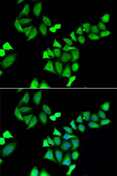 Anti-GALE Antibody (CAB6595)