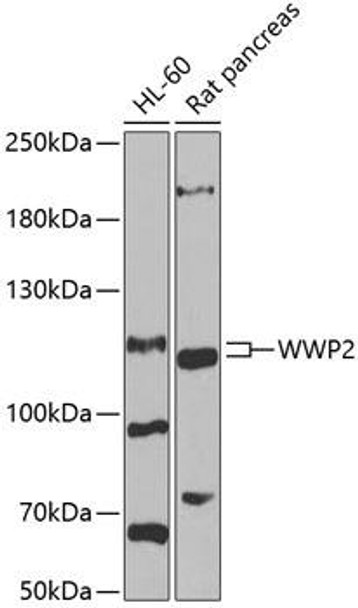 Anti-WWP2 Antibody (CAB6789)