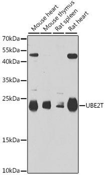 Anti-UBE2T Antibody (CAB6853)
