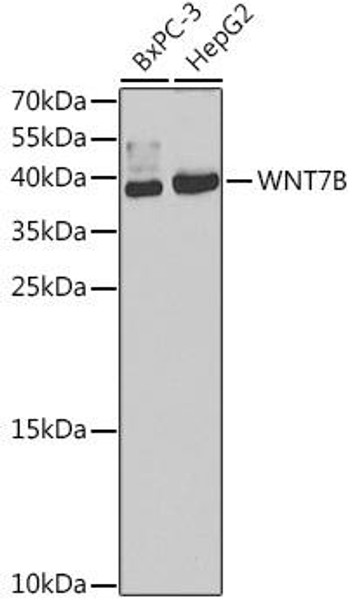 Anti-WNT7B Antibody (CAB7746)
