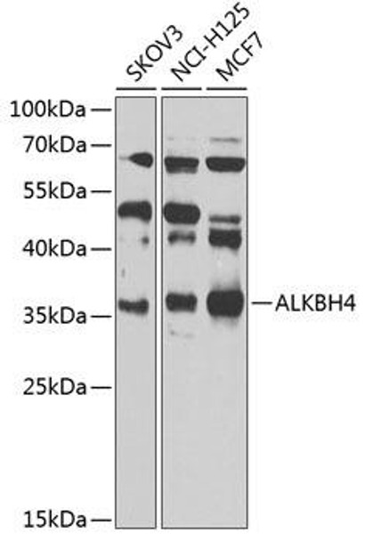 Anti-ALKBH4 Antibody (CAB7812)