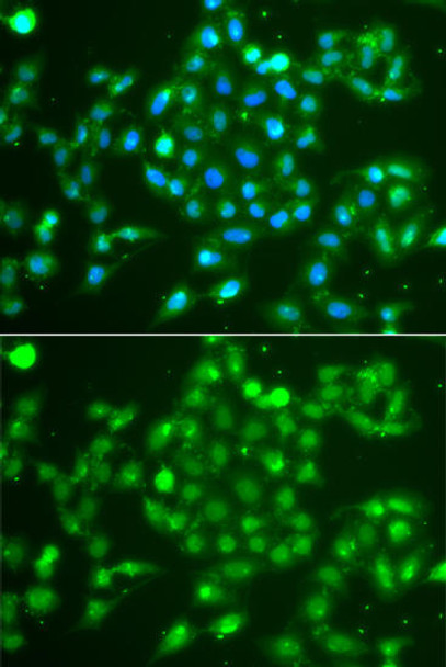 Anti-UCHL5 Antibody (CAB7978)