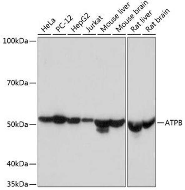 Anti-ATPB Antibody (CAB11214)