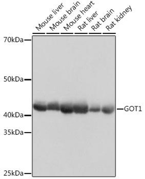 Anti-GOT1 Antibody (CAB11363)