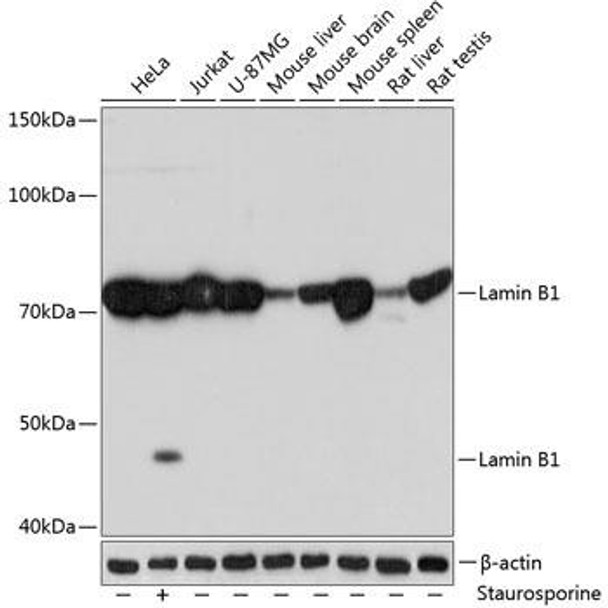 Anti-Lamin B1 Antibody (CAB11495)