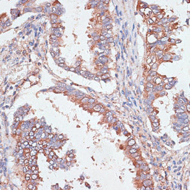 Anti-GAB1 Antibody (CAB16856)