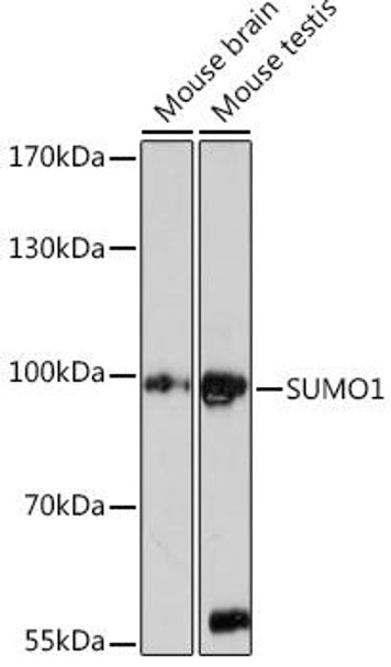 Anti-SUMO1 Antibody (CAB16994)