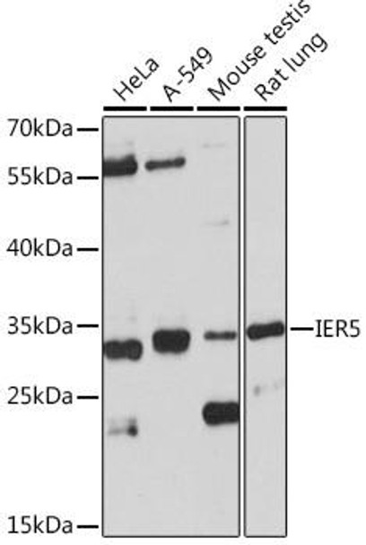 Anti-IER5 Antibody (CAB18457)