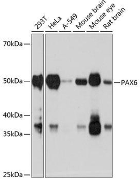 Anti-PAX6 Antibody (CAB19099)