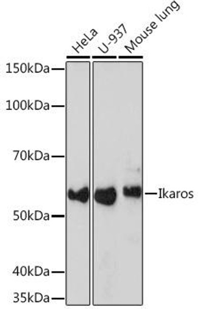 Anti-Ikaros Antibody (CAB3565)