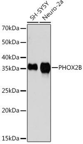 Anti-PHOX2B Antibody (CAB6816)