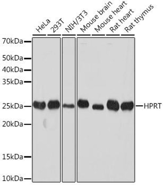 Anti-HPRT Antibody (CAB8783)