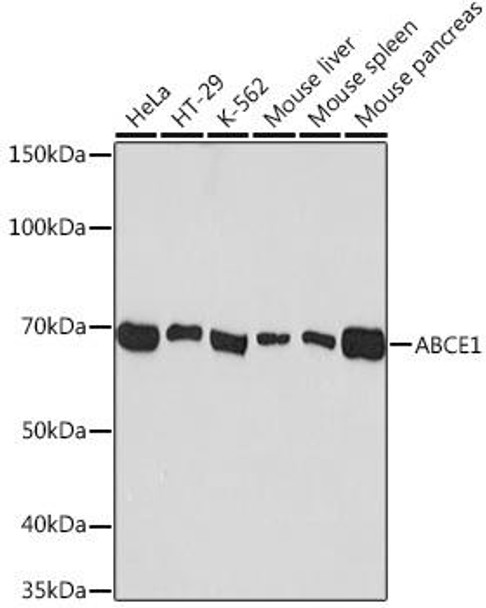 Anti-ABCE1 Antibody (CAB9135)