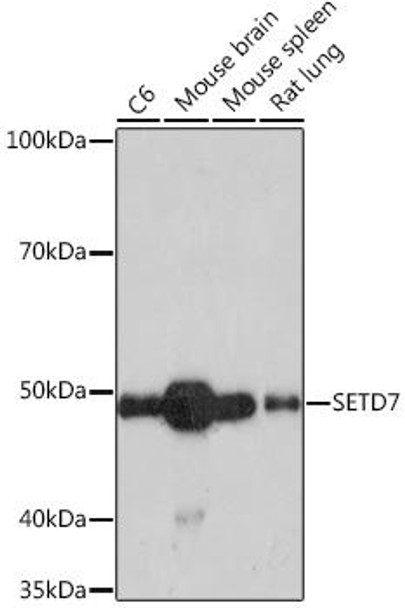 Anti-SETD7 Antibody (CAB9225)