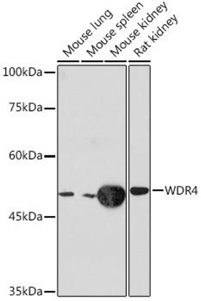 Anti-WDR4 Antibody (CAB19765)