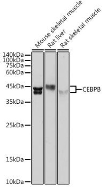 Anti-CEBPB Antibody (CAB0711)