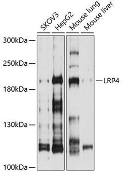 Anti-LRP4 Antibody (CAB10172)