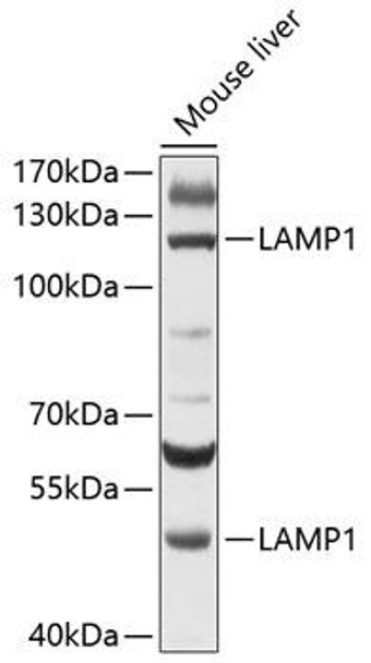 Anti-LAMP1 Antibody (CAB11468)