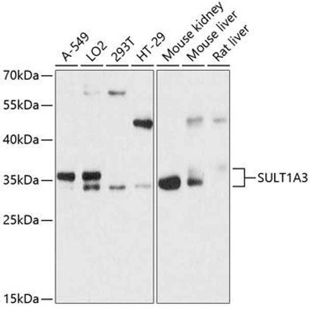Anti-SULT1A3 Antibody (CAB12357)