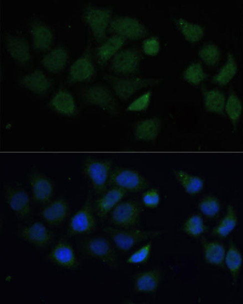 Anti-CPT2 Antibody (CAB12426)