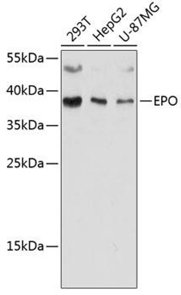 Anti-EPO Antibody (CAB12435)